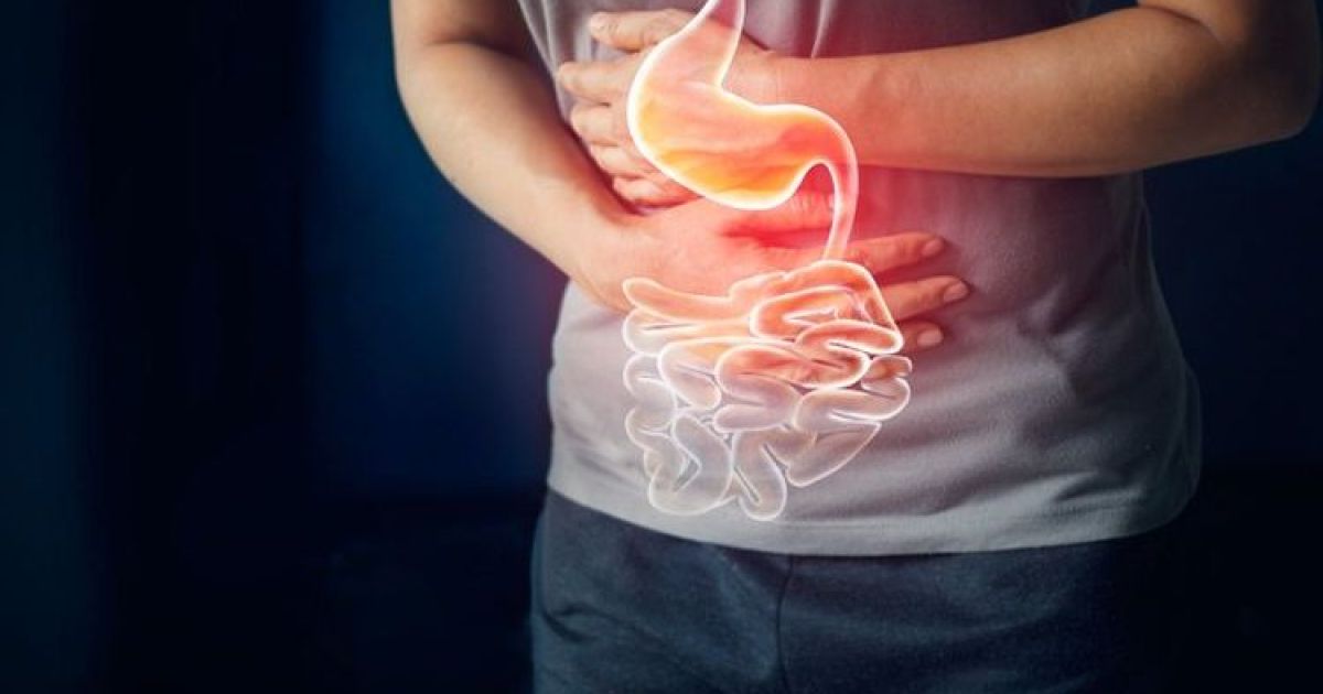 Serupa tapi Tak Sama, Ini Perbedaan Maag dan Asam Lambung Menurut Medis