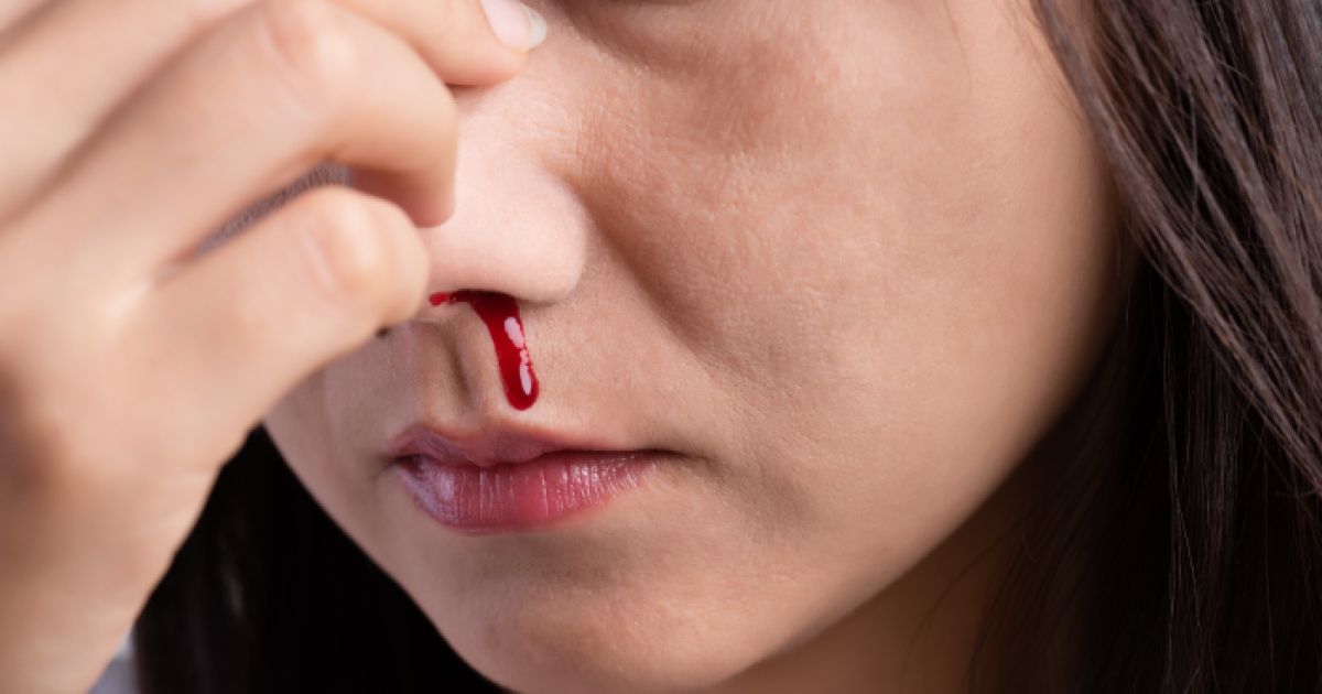 Mimisan: Penyebab, Cara Mengatasi, dan Tanda Bahaya yang Perlu Diwaspadai