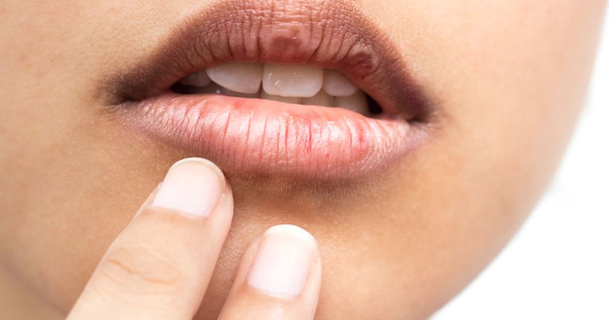 7 Cara Efektif Menghilangkan Bibir Hitam dan Mencegahnya Kembali