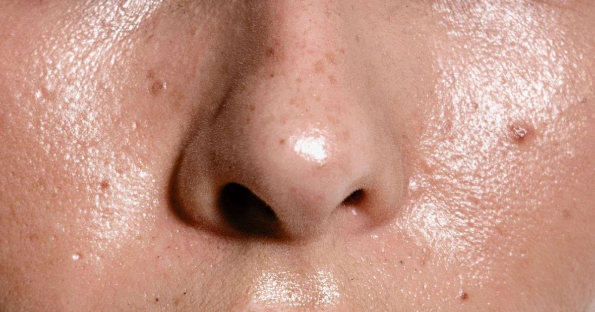 13 Cara Efektif Mengatasi Minyak Berlebih di Wajah Secara Alami dan Medis