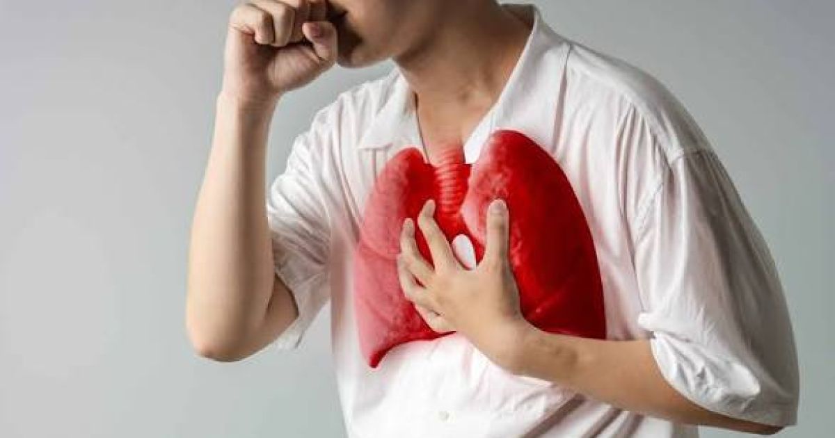 Indonesia Peringkat 3 Kasus TBC Dunia, Kenali Gejala dan Cara Penularannya