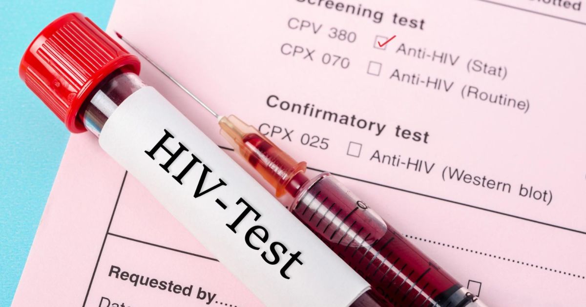 Waspada Penularan HIV: Kenali 6 Cara Penyebaran dan Langkah Pencegahannya