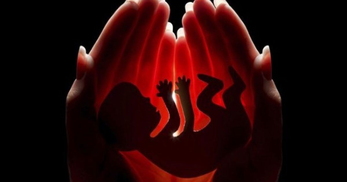 Mengenal Risiko Medis dan Aturan Hukum Tindakan Aborsi di Indonesia
