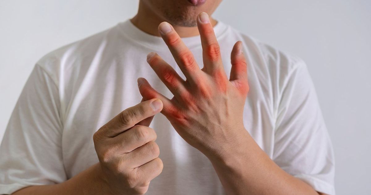 10 Pemicu Rematik Asam Urat yang Perlu Dihindari agar Tidak Mudah Kambuh