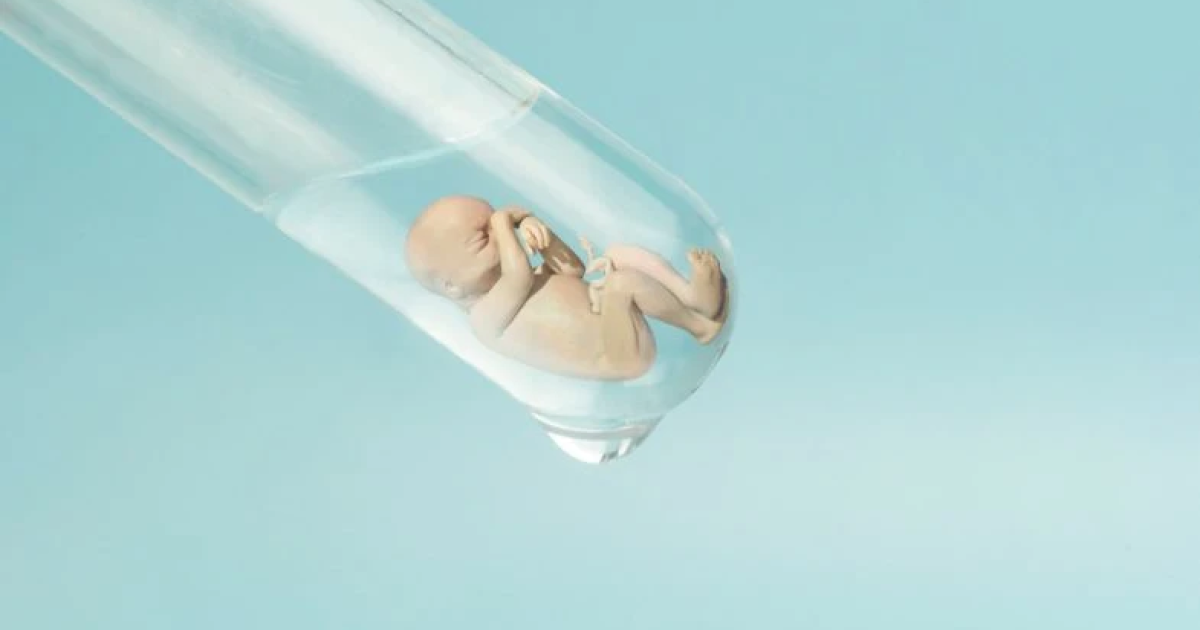 Mengapa Program Bayi Tabung Mahal? Ini Faktor yang Memengaruhi Biayanya