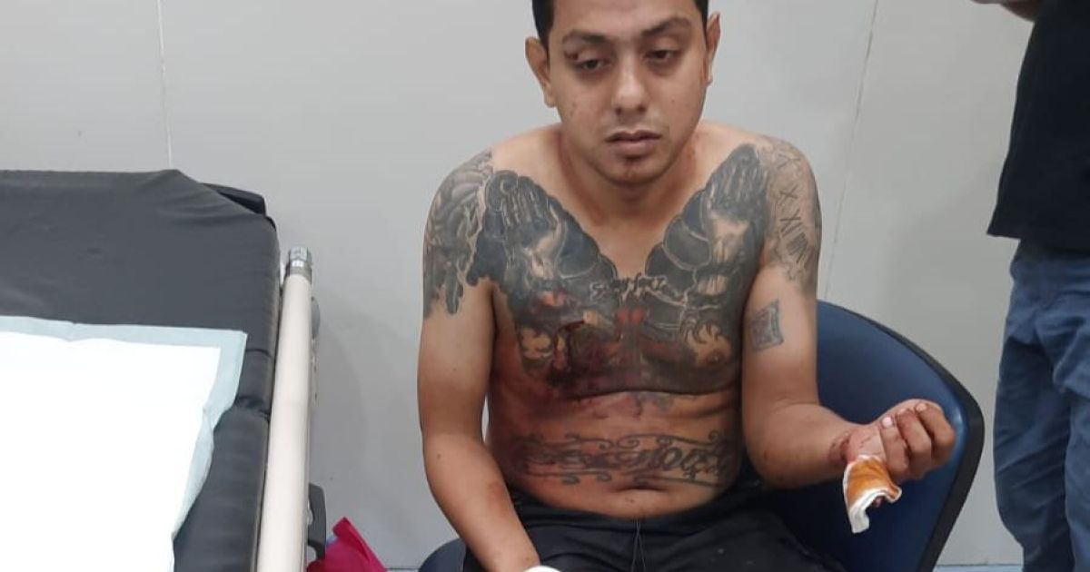 Pemotor di Rumpin Bogor Dibacok Begal, Tas Berisi Dokumen Berharga Raib