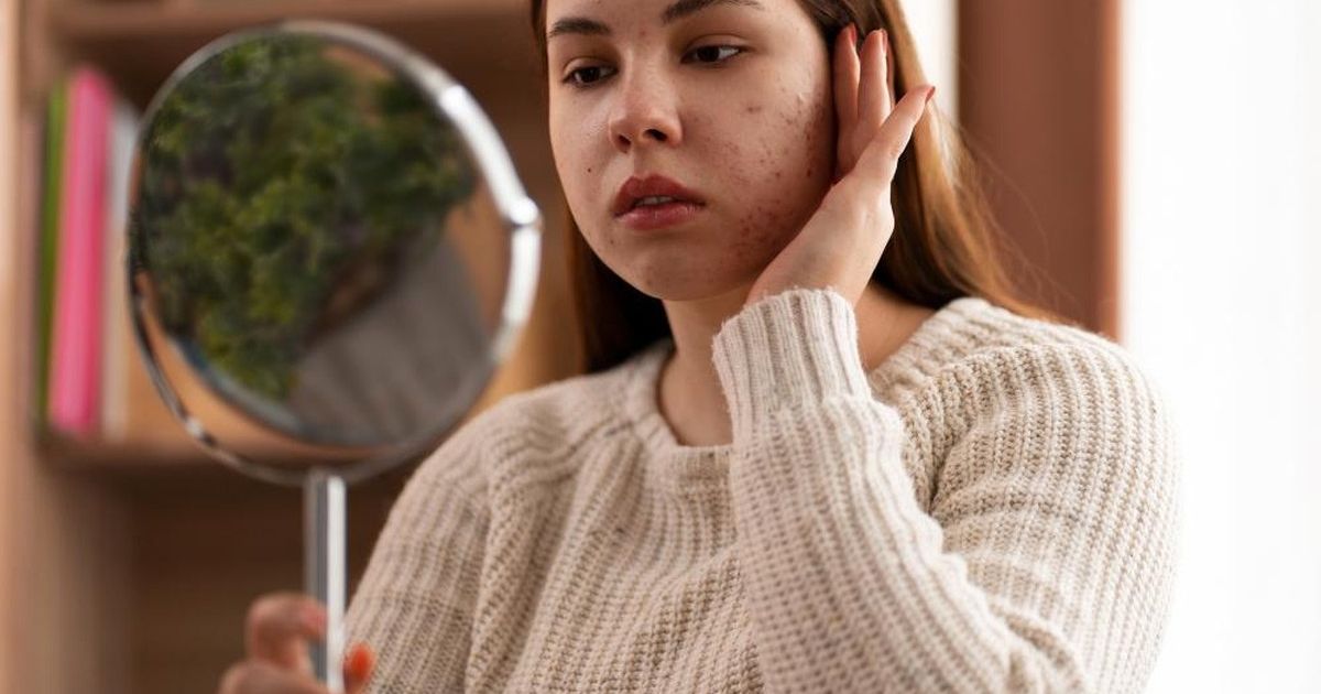 Waspada! 5 Kebiasaan Sehari-hari yang Diam-diam Merusak Kesehatan Kulit Wajah