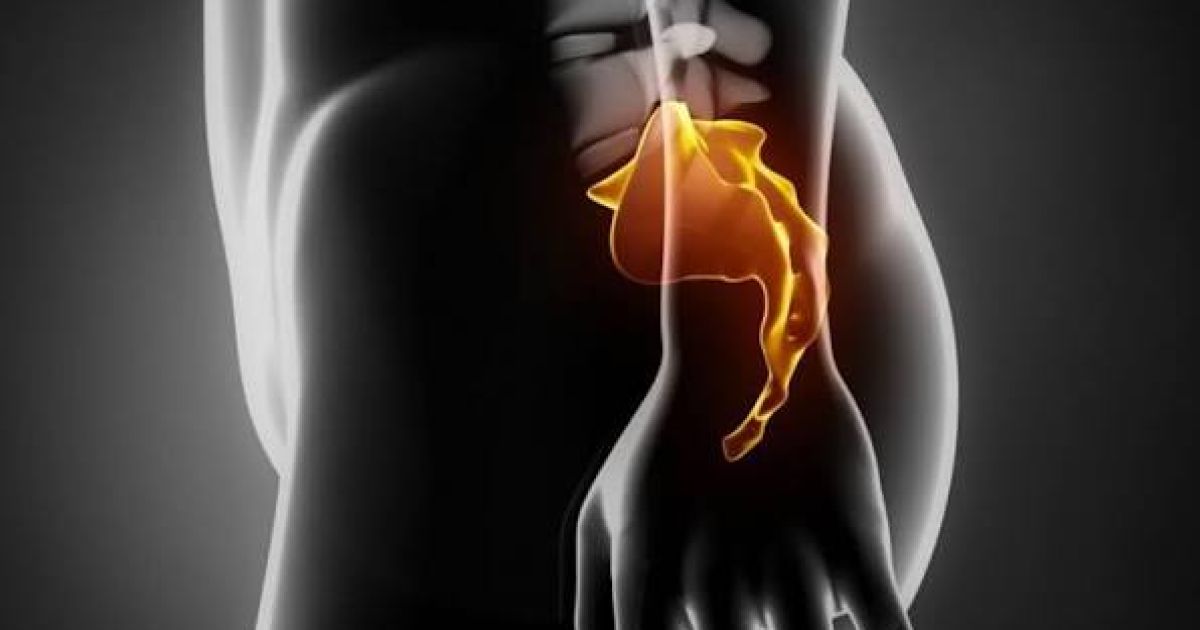Mengatasi Nyeri Tulang Ekor (Coccydynia): Penyebab, Gejala, dan Cara Mengatasi