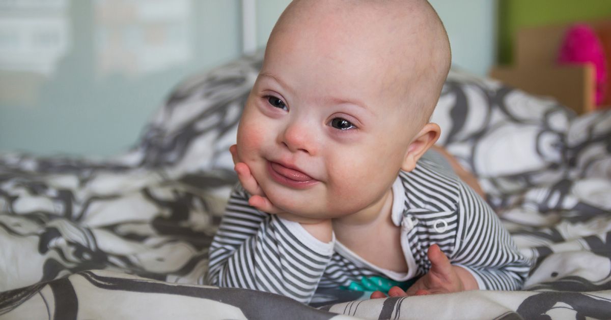 Cara Menurunkan Risiko Down Syndrome dan Pentingnya Skrining Kehamilan