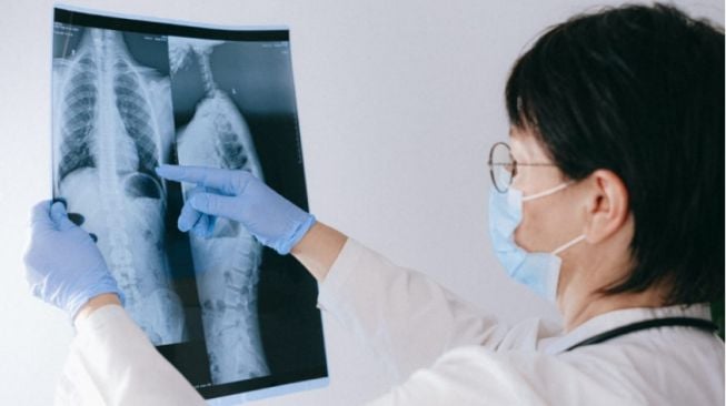 Angin Malam Rentan Alami Paru-Paru Basah, Mitos atau Fakta?