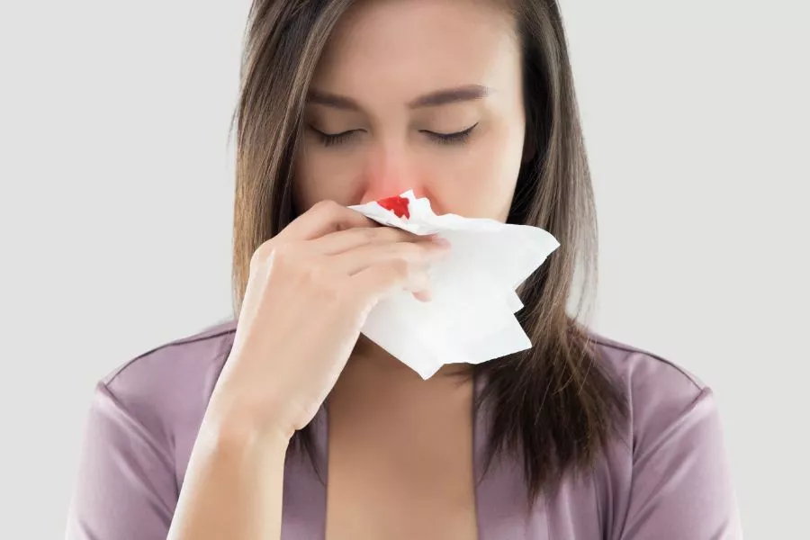 Kenali Penyebab dan Cara Mengatasi Mimisan dengan Tepat