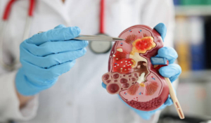 Cara Membesihkan Ginjal atau Detox Secara Alami