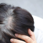 Faktor Penyebab Uban: Stres, Gaya Hidup, hingga Kekurangan Vitamin