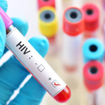 13 Gejala HIV pada Pria yang Perlu Diwaspadai, dari Tahap Awal hingga AIDS