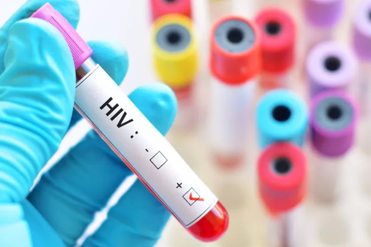 13 Gejala HIV pada Pria yang Perlu Diwaspadai, dari Tahap Awal hingga AIDS
