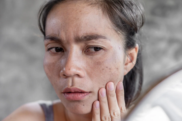 11 Cara Ampuh Merawat Wajah agar Tidak Kusam, Mudah Dilakukan di Rumah